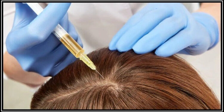 گرتے بال روکنے کا مؤثر ترین علاج