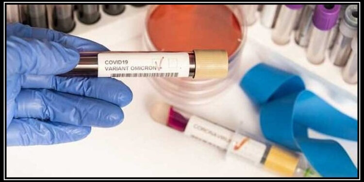 پاکستان میں کورونا کے مزید 473 کیسز اور 4 اموات ریکارڈ