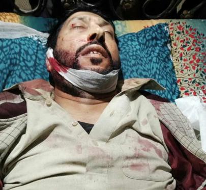 تحریک آزادیِ جموں کشمیر کیلئے حزب کمانڈر امتیاز عالم شہید کی انتھک اور لازوال جدوجہد کو تاریخِ کشمیر میں سنہری حروف سے لکھا جائے گا۔ پاسبان حریت
