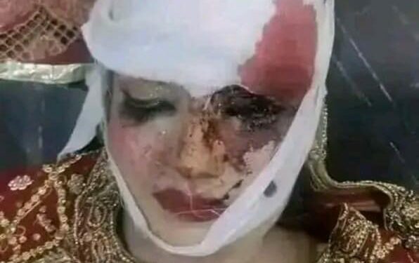 بھکر:پسند کی شادی نہ ہونے کا رنج، کزن نے دلہن بنی چچا زاد کو قتل کر دیا
