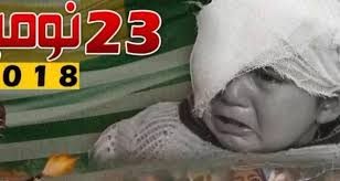 مقبوضہ کشمیر کی تاریخ میں بھارتی افواج کی بربریت سے متاثرہ کمسن بچی، بھارتی جبر کا سیاہ باب