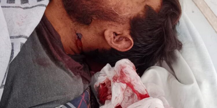 تھانہ الفلاح ڈاکوؤں ۔منشیات فروشوں۔کرمنلز کی آماجگاہ بن گیا البدر سوسائٹی میں دو ڈاکوؤں کی فائرنگ سے 25:سالہ نوجوان شعیب جان کی بازی ہارگیا۔