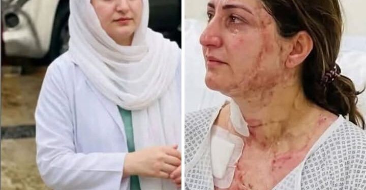 کوئٹہ میں تیزاب گردی ۔ ڈاکٹر ماہ نور ناصر پر حملہ کرنے والا مرد تھا۔ بچانے کی کوشش کرنے والا بھی مرد تھا : عبدالرازق بہادری کا استعارہ بن گیا